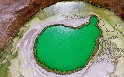 Потенциалното лечение на ендометриоза с хормон от бъбреците?